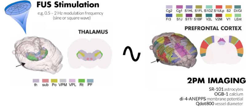 Two-photon microscopy brain vasculature at Sunnybrook